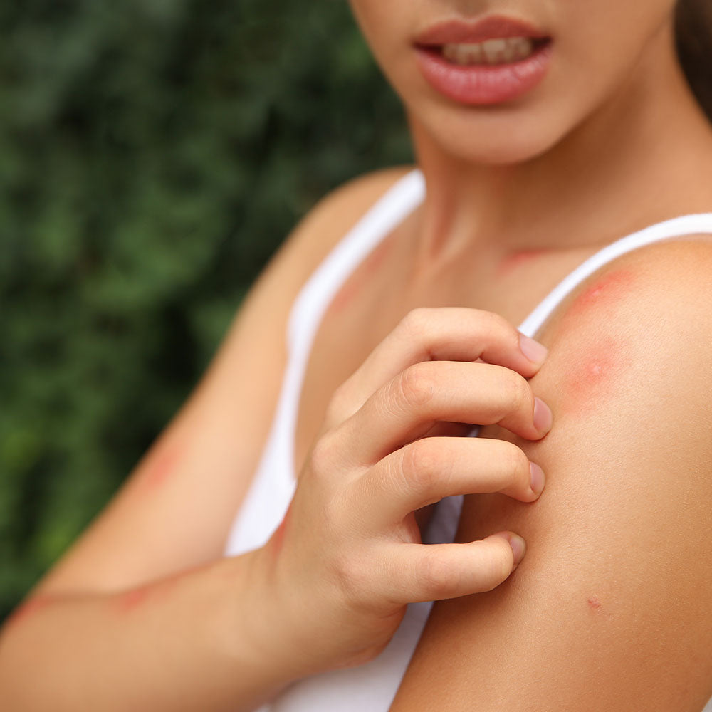 Les huiles essentielles anti-moustique